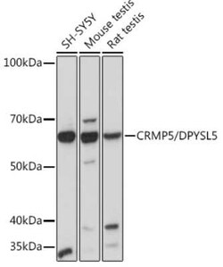 CRMP5 Rabbit anti-Human, Mouse, Rat, Clone: 5L4S8, Novus Biologicals 20 &mu;g | Buy Online | Novus Biologicals | Fisher Scientific