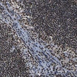 CROP Antibody, Novus Biologicals:Antibodies:Primary Antibodies