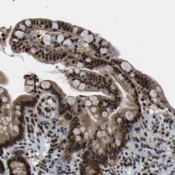 CROP Antibody, Novus Biologicals:Antibodies:Primary Antibodies