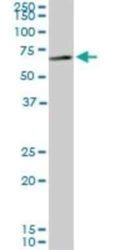 CROT Antibody (1A6), Novus Biologicals 0.1 mg, Unconjugated:Antibodies,
