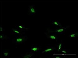 CRX/CORD2 Antibody (4A12), Novus Biologicals 0.1 mg | Buy Online | Novus Biologicals | Fisher Scientific