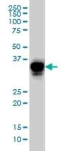 CRX/CORD2 Antibody (4G11), Novus Biologicals 0.1 mg; Unconjugated:Antibodies,