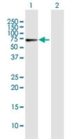 CRY1 Antibody, Novus Biologicals 50 &mu;g; Unconjugated:Antibodies, Polyclonal