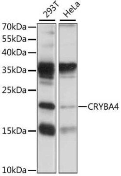 CRYBA4 Antibody - Azide and BSA Free, Novus Biologicals:Antibodies:Primary