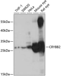 CRYBB2 Antibody - BSA Free, Novus Biologicals 0.02 mL, Unconjugated:Antibodies,