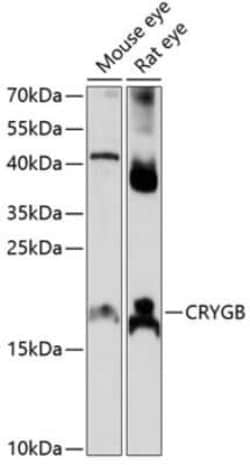CRYGB Antibody - Azide and BSA Free, Novus Biologicals:Antibodies:Primary