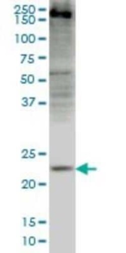 CRYGD Antibody (4E12), Novus Biologicals 0.1 mg | Buy Online | Novus Biologicals | Fisher Scientific