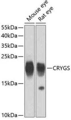 CRYGS Antibody - BSA Free, Novus Biologicals 0.02 mL, Unconjugated:Antibodies,