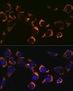 CS Citrate Synthase Rabbit anti-Human, Mouse, Rat, Clone: 4Z10Z8, Novus