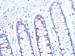 CS Citrate Synthase Rabbit anti-Human, Mouse, Rat, Clone: 4Z10Z8, Novus
