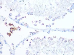 CS Citrate Synthase Rabbit anti-Human, Mouse, Rat, Clone: 4Z10Z8, Novus