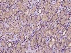 CSAD Antibody, Novus Biologicals:Antibodies:Primary Antibodies