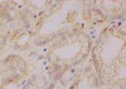 CSE1L/CAS/Exportin-2 Antibody (3D8), Novus Biologicals 0.1 mg | Buy Online | Novus Biologicals | Fisher Scientific