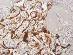 CSH2 Antibody, Novus Biologicals 50 &mu;g | Buy Online | Novus Biologicals | Fisher Scientific