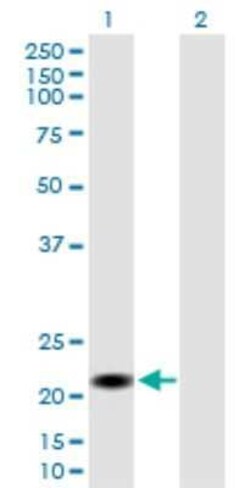 CSH2 Antibody, Novus Biologicals 50 &mu;g | Buy Online | Novus Biologicals | Fisher Scientific