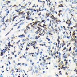 CSK Rabbit anti-Human, Mouse, Rat, Clone: 1A2F5, Novus Biologicals:Antibodies:Primary