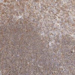 CSK Antibody, Novus Biologicals 25 &mu;L | Buy Online | Novus Biologicals | Fisher Scientific