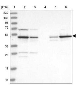CSK Antibody, Novus Biologicals 25 &mu;L | Buy Online | Novus Biologicals | Fisher Scientific