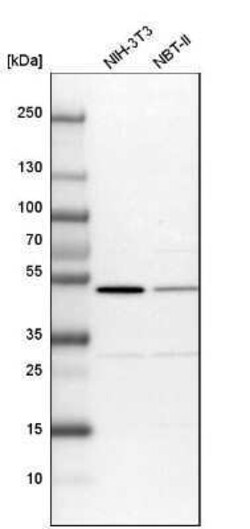 CSK Antibody, Novus Biologicals 25 &mu;L | Buy Online | Novus Biologicals | Fisher Scientific