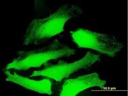 CSP Antibody, Novus Biologicals 50 &mu;g; Unconjugated:Antibodies, Polyclonal