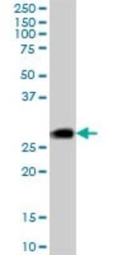 CSP Antibody, Novus Biologicals 50 &mu;g; Unconjugated:Antibodies, Polyclonal