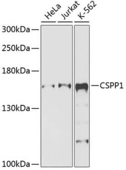 CSPP Antibody - BSA Free, Novus Biologicals 0.02 mL, Unconjugated:Anticorps,