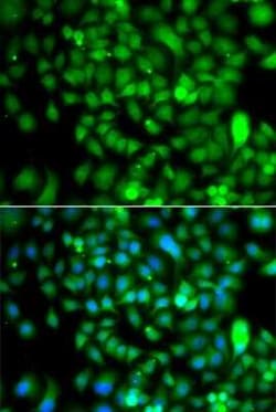 CSRP2BP Antibody - BSA Free, Novus Biologicals 0.1 mL, Unconjugated:Antibodies,