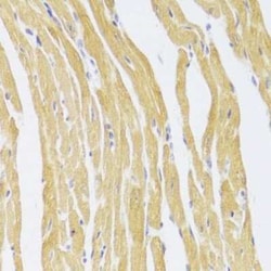 CSRP3 Antibody - BSA Free, Novus Biologicals:Antibodies:Primary Antibodies