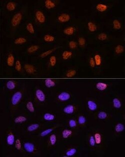 CSTF2T Antibody - BSA Free, Novus Biologicals:Antibodies:Primary Antibodies