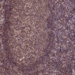 CSTF2T Antibody, Novus Biologicals 25 &mu;L, Unconjugated:Antibodies, Polyclonal