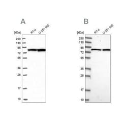 CSTF3 Antibody, Novus Biologicals 25 &mu;L; Unconjugated:Antibodies, Polyclonal