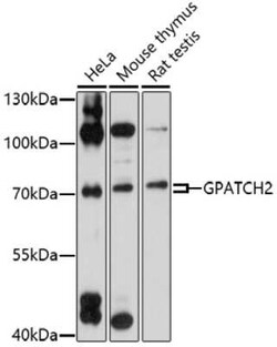 CT110 Antibody - Azide and BSA Free, Novus Biologicals 0.1 mL, Unconjugated:Antibodies,