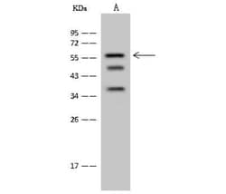 CT110 Antibody, Novus Biologicals™