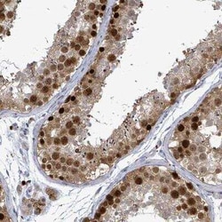 CT45A1 Antibody, Novus Biologicals:Antibodies:Primary Antibodies