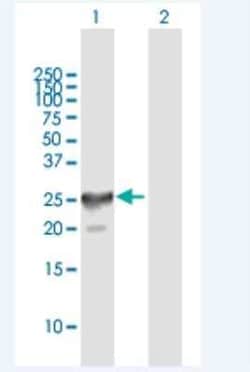 CT45A4 Antibody, Novus Biologicals 50 &mu;g; Unconjugated:Antibodies, Polyclonal