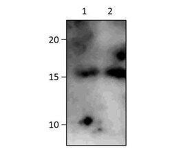 CT83 Antibody, Novus Biologicals 100 &mu;g; Unconjugated:Antibodies, Polyclonal