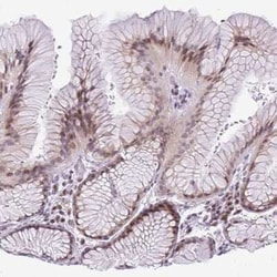 CTB-133G6.1 Antibody, Novus Biologicals 0.1 mL | Buy Online | Novus Biologicals | Fisher Scientific