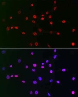 CTBP2 Rabbit anti-Human, Mouse, Rat, Clone: 1R1U6, Novus Biologicals 100 &mu;g | Buy Online | Novus Biologicals | Fisher Scientific