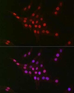 CTBP2 Rabbit anti-Human, Mouse, Rat, Clone: 1R1U6, Novus Biologicals 100 &mu;g | Buy Online | Novus Biologicals | Fisher Scientific