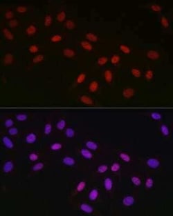 CTBP2 Rabbit anti-Human, Mouse, Rat, Clone: 1R1U6, Novus Biologicals 100 &mu;g | Buy Online | Novus Biologicals | Fisher Scientific