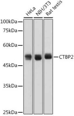 CTBP2 Rabbit anti-Human, Mouse, Rat, Clone: 1R1U6, Novus Biologicals 100 &mu;g | Buy Online | Novus Biologicals | Fisher Scientific