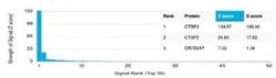CTBP2 Mouse anti-Human, Clone: PCRP-CTBP2-2D11, Novus Biologicals:Antibodies:Primary