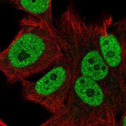 CTC-534A2.2 Antibody, Novus Biologicals:Antibodies:Primary Antibodies