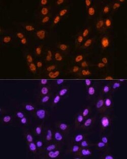 CTCF Rabbit anti-Human, Mouse, Rat, Clone: 4W9B0, Novus Biologicals 100 &mu;g | Buy Online | Novus Biologicals | Fisher Scientific