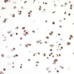CTCF Antibody (BLR041F), Novus Biologicals 100 &mu;L; Unconjugated:Antibodies,