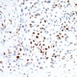 CTCF Antibody (BLR041F), Novus Biologicals 100 &mu;L; Unconjugated:Antibodies,