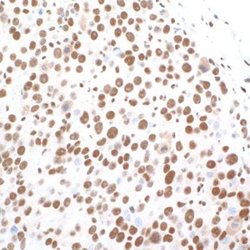 CTCF Antibody (BLR041F), Novus Biologicals 100 &mu;L; Unconjugated:Antibodies,