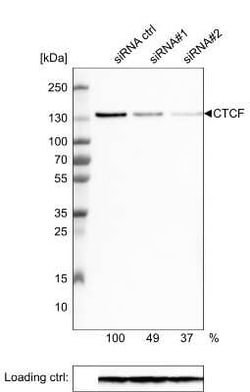 CTCF Antibody (CL0304), Novus Biologicals 0.1 mL, Unconjugated:Antibodies,