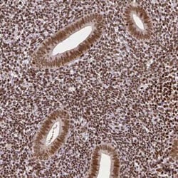 CTCF Antibody (CL0305), Novus Biologicals 25 &mu;L, Unconjugated:Antibodies,