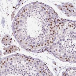CTCF Antibody (CL0305), Novus Biologicals 25 &mu;L, Unconjugated:Antibodies,